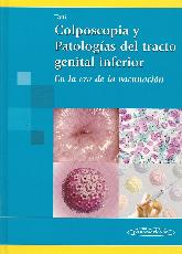 Colposcopia y Patologas del Tracto Genital Inferior