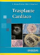 Trasplante Cardaco