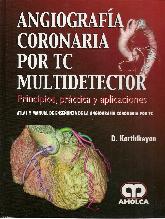 Angiografía Coronaria por TC Multidetector