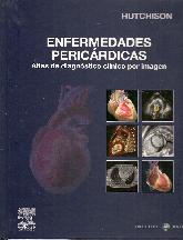 Enfermedades pericardicas con DVD