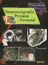 Neuroecografia Prenatal y Neonatal