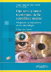 Ojo Seco y otros trastornos de la superficie ocular