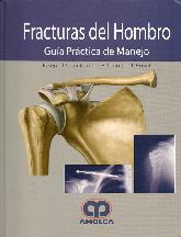 Fracturas del Hombro