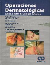 Operaciones Dermatologicas