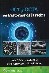 OCT y OCTA en trastornos de la retina