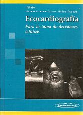 Ecocardiografa para la toma de decisiones