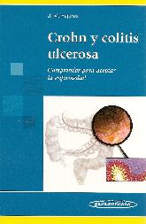 Crohn y colitis ulcerosa