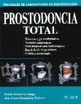 Prostodoncia total