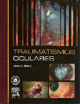 Traumatismos Oculares