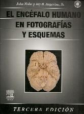 El Encefalo Humano en Fotografias y Esquemas