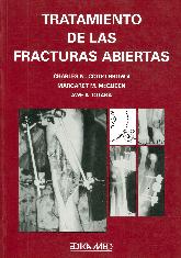 Tratamiento de las fracturas abiertas