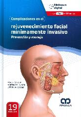 Complicaciones en el rejuvenecimiento facial mnimamente invasivo.Prevencin y manejo