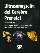 Ultrasonografía del cerebro prenatal