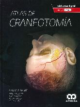 Atlas de craneotoma