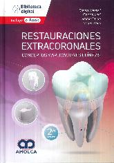 Restauraciones extracoronales. Conceptos y aplicaciones clnicas