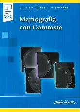 Mamografa con contraste