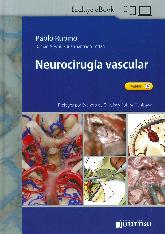 Neurociruga vascular
