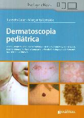 Dermatoscopia peditrica