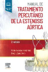 Manual de Tratamiento Percutneo de la Estenosis Artica