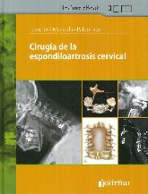 Ciruga de la Espondiloartrosis Cervical