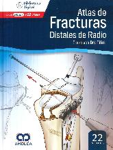 Atlas de Fracturas Distales de Radio