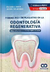 Fibrina Rica en Plaquetas en la Odontologa Regenerativa
