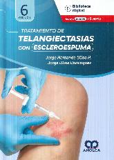 Tratamiento de telangiectasias con escleroespuma