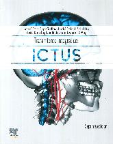 Tratamiento integral del ictus 