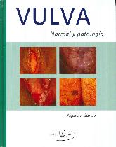 Vulva