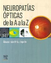 Neuropatas pticas de la A a la Z