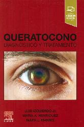 Queratocono. Diagnstico y tratamiento