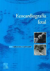 Ecocardiografa fetal