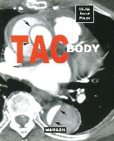 Fundamentos de TAC BODY