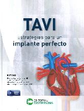 TAVI Estrategias para un implante perfecto