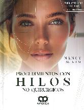 Procedimientos con hilos no quirrgicos.