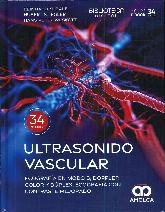 Ultrasonido vascular. Ecografa en Modo B, Doppler color y dplex, ecografa con contraste mejorado