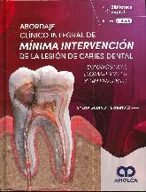 Abordaje clnico integral de mnima intervencin de la lesin de caries dental