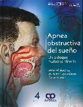 Apnea obstructiva del sueo. Un enfoque multidisciplinario