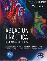 Ablacin prctica