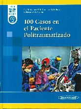 100 Casos en el paciente politraumatizado