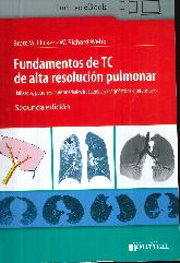 Fundamento de TC de alta resolucin pulmonar