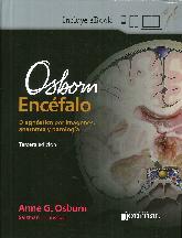OBSBORN Encfalo. Diagnstico por imgenes, anatoma y patologa