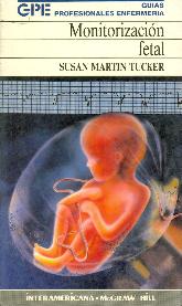 Monitorizacion Fetal
