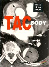 TAC Body