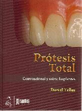 Prtesis Total