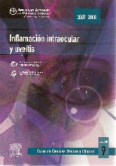 Inflamacin intraocular y uvetis