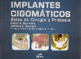 Implantes Cigomticos