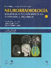 Neurorradiología. Radiología y diagnóstico por imágenes