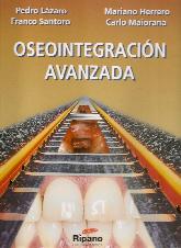 Oseointegracin Avanzada