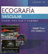 Ecografa vascular